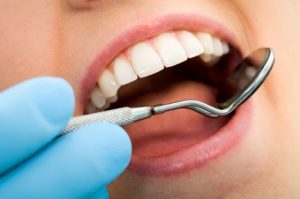 what dental exam reveals