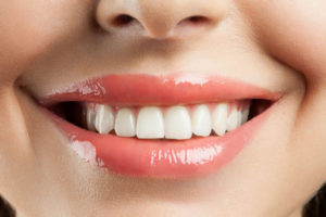 Teeth Whitening in Irvine