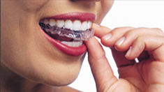 Invisalign Orthodontics  in Irvine